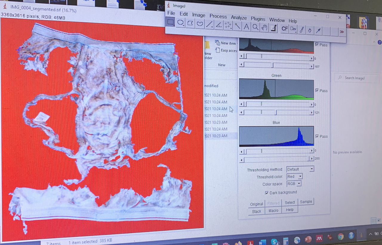 Digitale Auswertung der zerfressenen Unterhosen